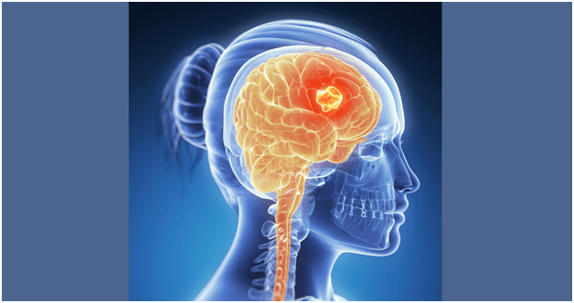 MRIs in the course of the most recent couple of years have looked decent