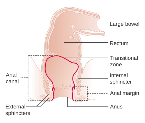 What is Anal-Cancer|Causes|Symptoms 