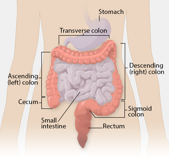 Colon cancer | onesmarterhealthweb