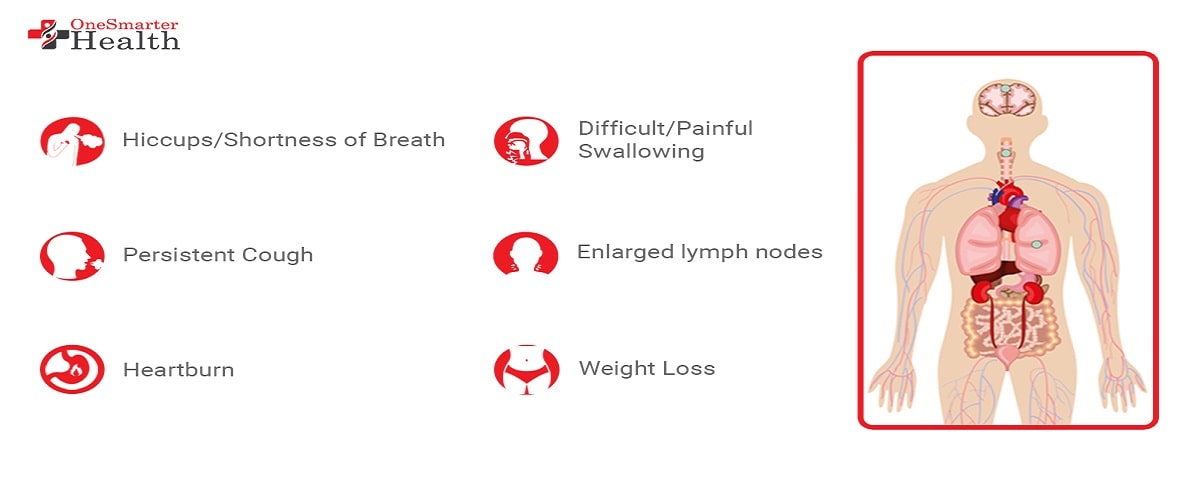 Esophageal cancer